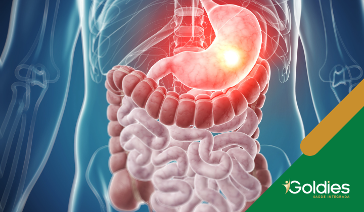 Ilustração do sistema digestivo humano destacando o estômago e os intestinos. O estômago é iluminado em vermelho, indicando foco ou atividade. O fundo mostra um torso semitransparente. Um logotipo com Goldies Saúde Integrada está no canto.