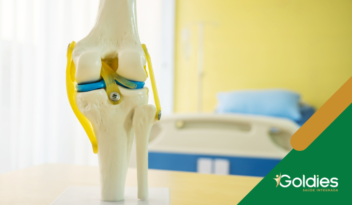 Um modelo anatômico detalhado de uma articulação do joelho mostrando ossos, ligamentos e cartilagem em uma mesa em uma sala iluminada. Uma cama com um travesseiro azul é visível ao fundo. Logotipo Goldies no canto inferior direito.