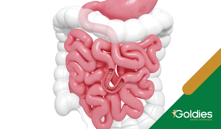 Ilustração do sistema digestivo humano, destacando os intestinos. O estômago e os intestinos são retratados em rosa, cercados por branco. O logotipo Goldies está no canto.